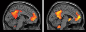 Daniel Schacter Functional MRI Scans